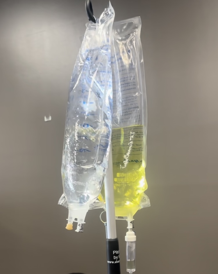 The Benefits Of IV Therapy